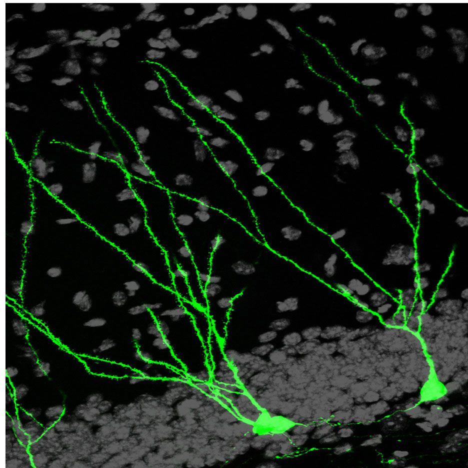 neurogenesis